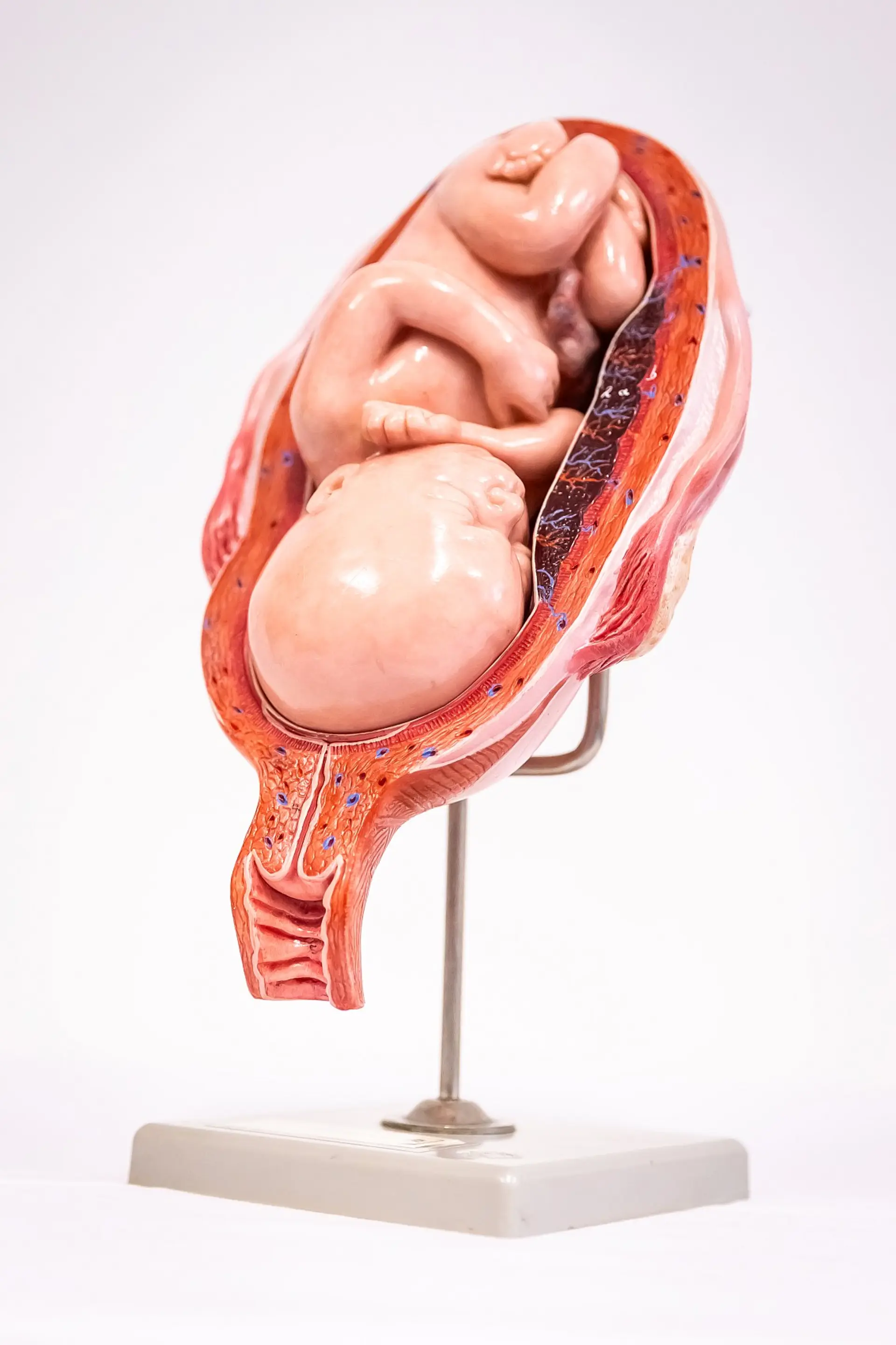 Ein detailliertes anatomisches Modell eines menschlichen Fötus im Uterus, im Längsschnitt dargestellt, steht auf einem metallenen Ständer mit einem Sockel. Das Modell zeigt den Fötus in einer gekrümmten Position innerhalb des Uterus, wobei die Gebärmutterwand in Schichten (Muskeln, Blutgefäße) dargestellt ist. 